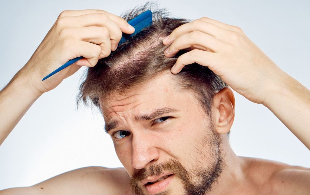 Nguyên nhân và cách trị rụng tóc ở nam